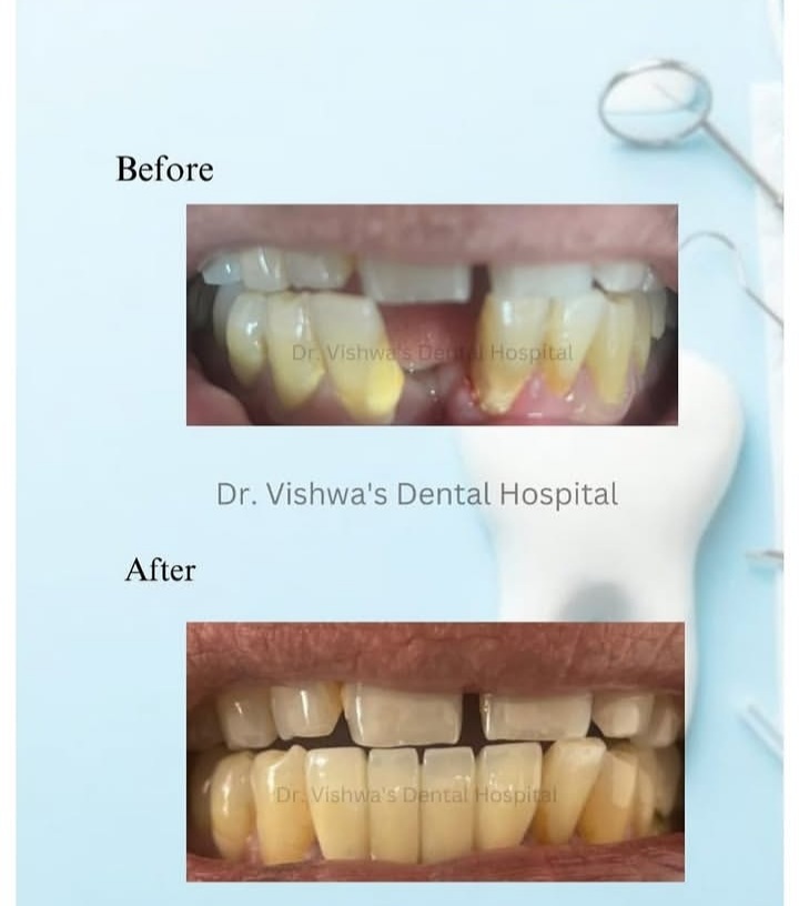 Patient transformation