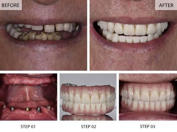 Patient transformation