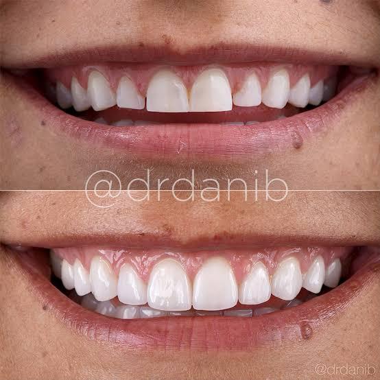 Patient transformation