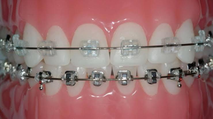 Patient transformation