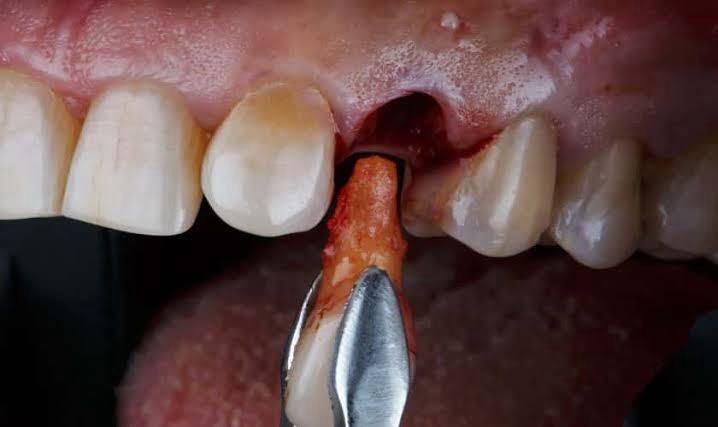 Patient transformation