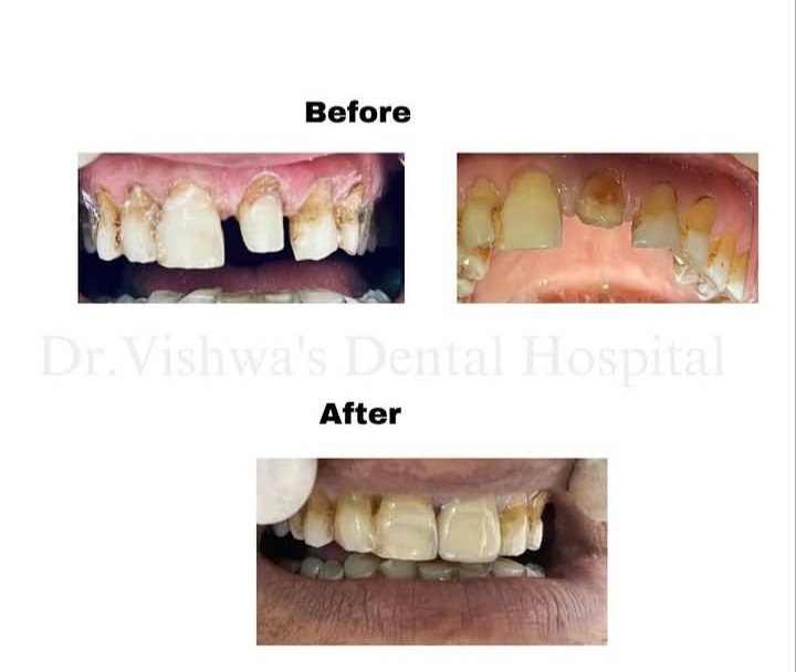 Patient transformation