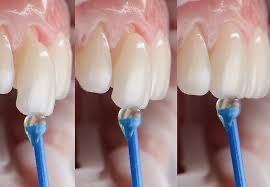 Patient transformation