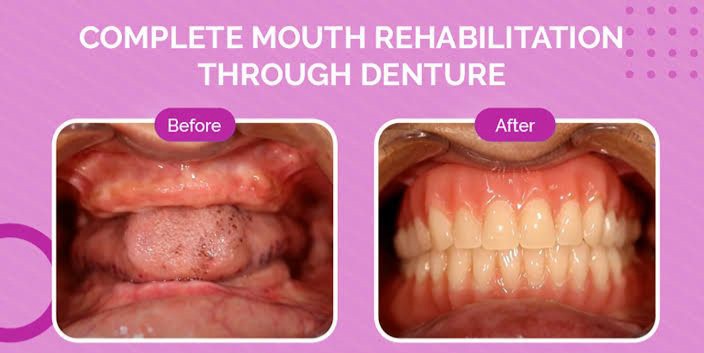 Patient transformation