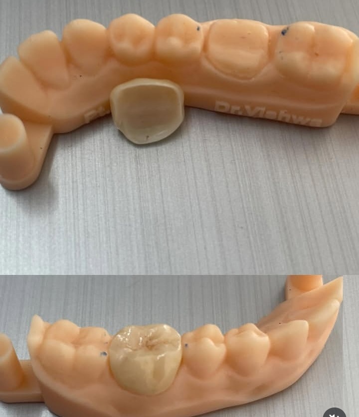 Patient transformation