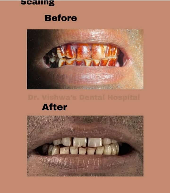 Patient transformation