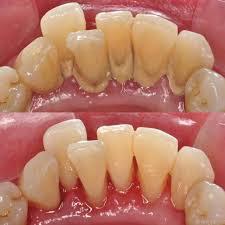 Patient transformation